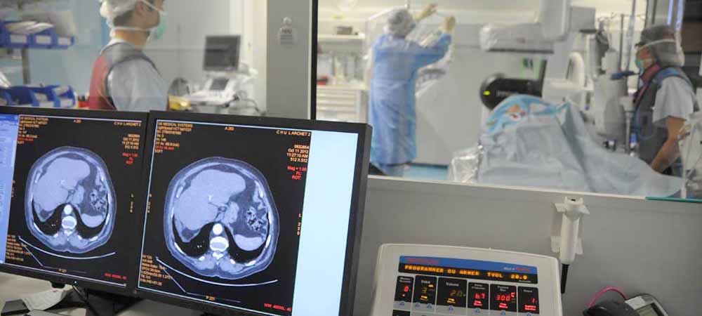 Équipe médicale en bloc opératoire analysant des scanners abdominaux sur écrans, intervention chirurgicale assistée par imagerie, technologie médicale avancée, salle d'opération moderne, soins hospitaliers, radiologie interventionnelle.